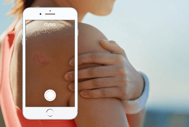 Disease recognition app example Disease recognition app example